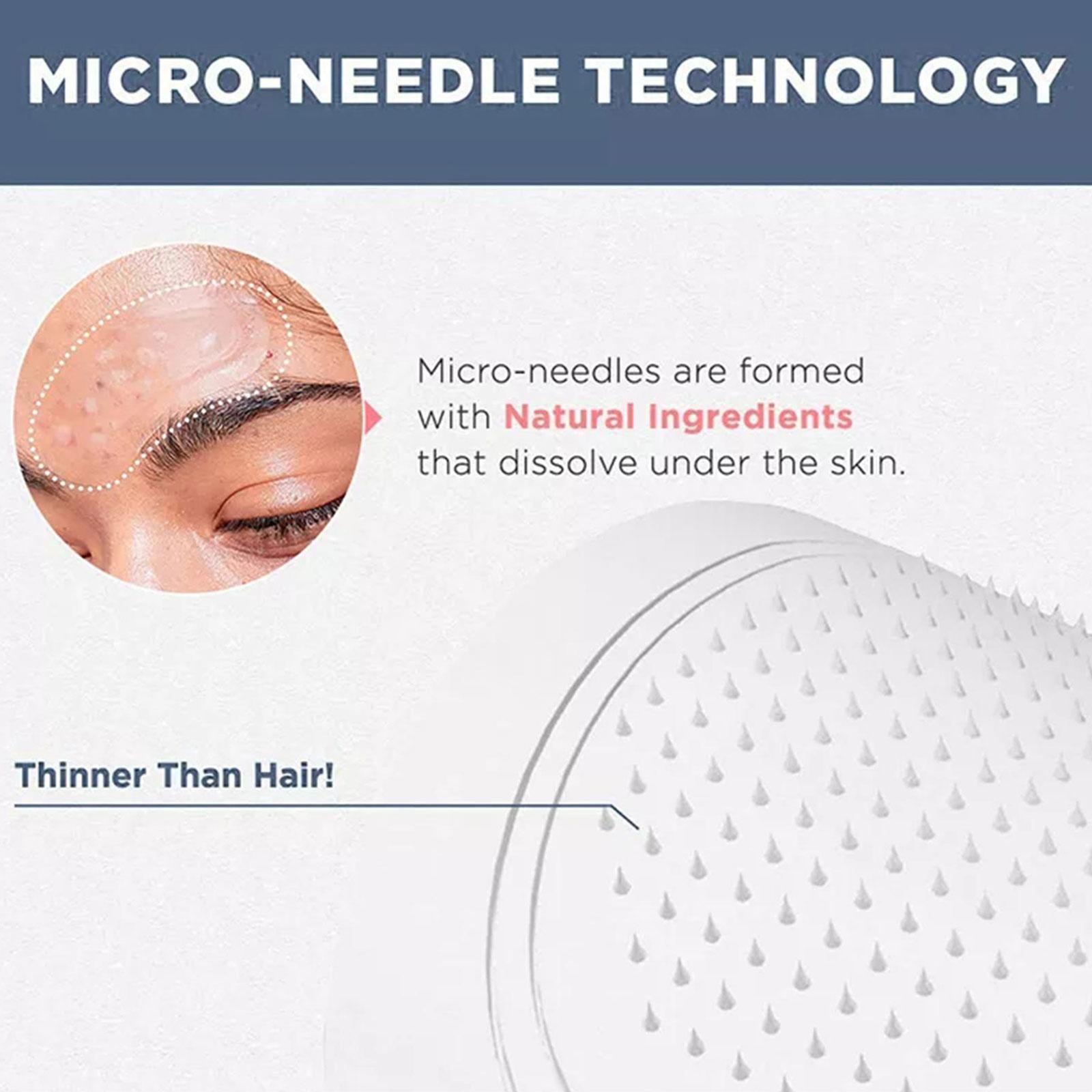แผ่นมาส์กใต้ตาไมโคร-นีดเดิล 0. - Microneedle Patch Eye บทวิจารณ์และราคา